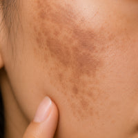 PIGMENTATION